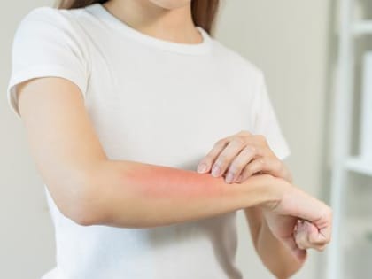 В Шахтах началась Неделя профилактики кожных заболеваний