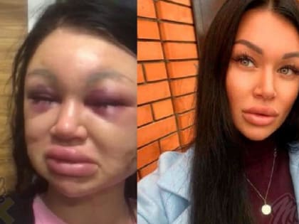 «Девушка в больнице»: в Таганроге мужчина жестоко избил свою возлюбленную