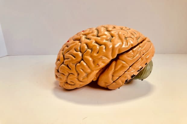 a model of the human brain