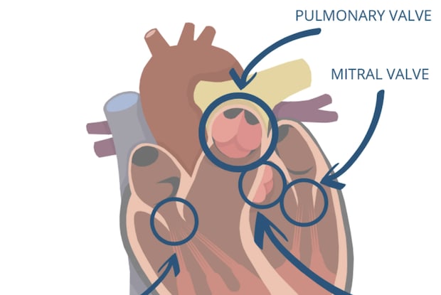 a diagram of the heart