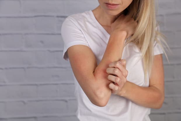 a woman scratching her elbow