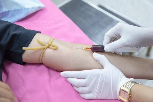 A needle injected into an arm