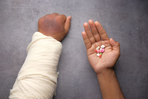 an arm in a cast and the other hand holding pills