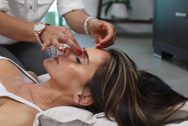 a woman receiving acupuncture