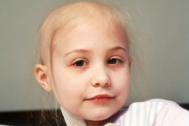 young child losing hair