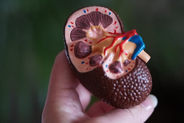 a diagram of a kidney