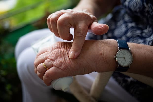 an older person kneading their hand