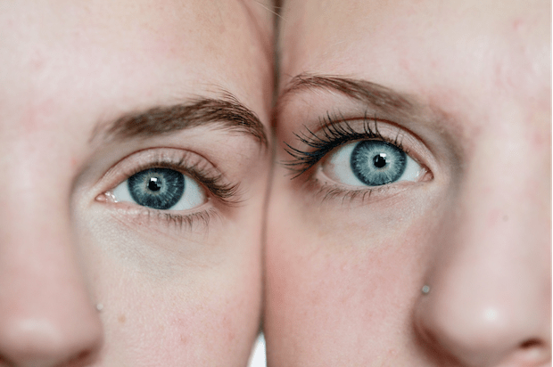 blue eyes and fair skin