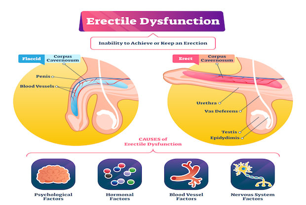 a diagram explaining ED