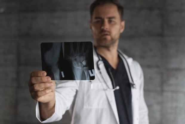 A doctor looking at an x-ray of a fracture