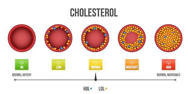 a graph showing healthy and bad cholesterol levels