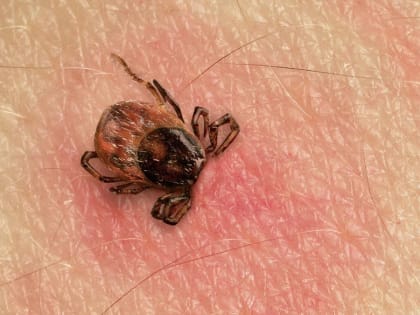 Клещей не пугает даже прохладная погода