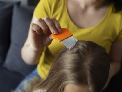 В Красноярском крае стали меньше болеть педикулёзом