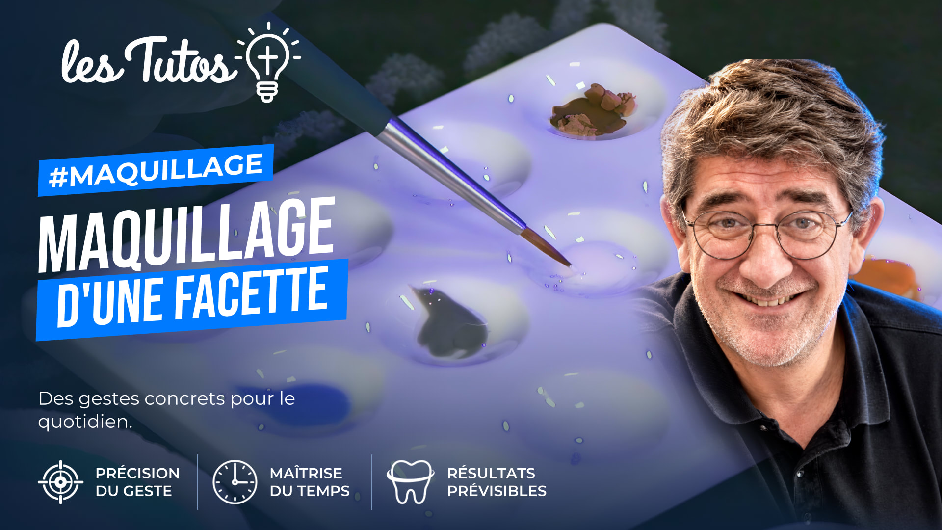 Maquillage d'une facette (Tuto, saison 2 épisode 24) : Maquillage d'une facette en LiSi A2 LT 14