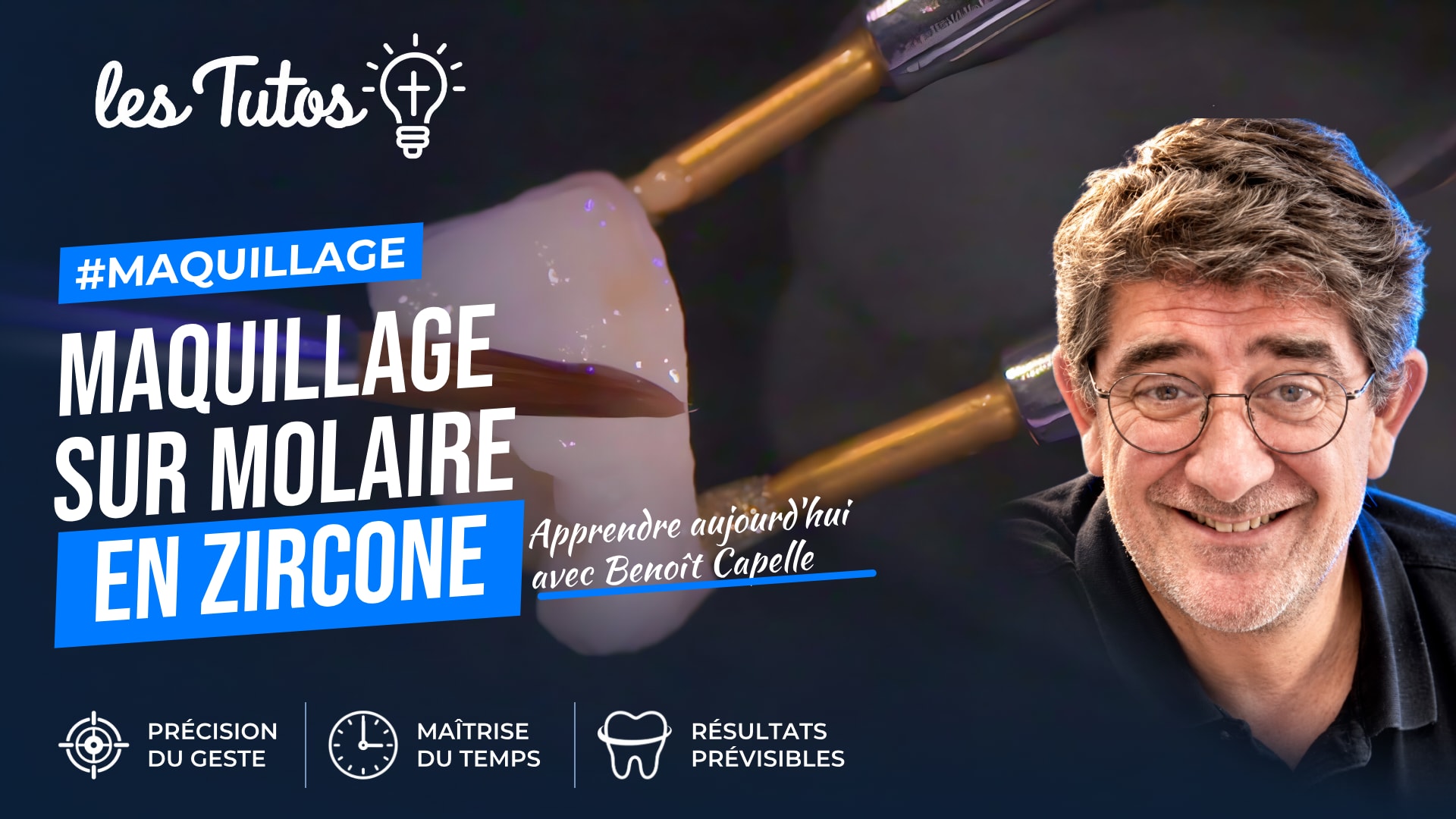 Maquillage sur molaire en zircone (Tuto, saison 2 épisode 28) : Démonstration technique muette de Benoit Capelle : le maquillage d'une molaire en…