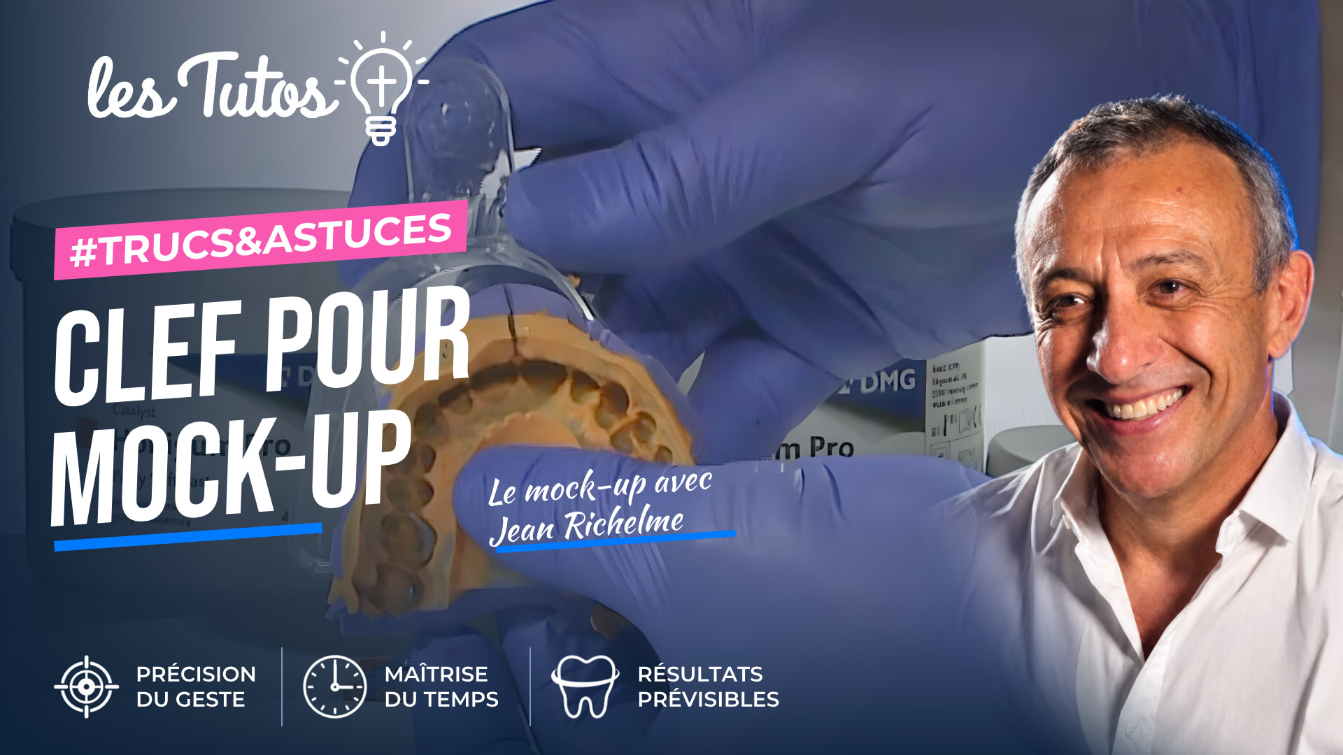 Clef pour mock-up (Tuto, saison 1 épisode 7) : Réalisation d'un porte-empreinte individualisé d'après un wax-up