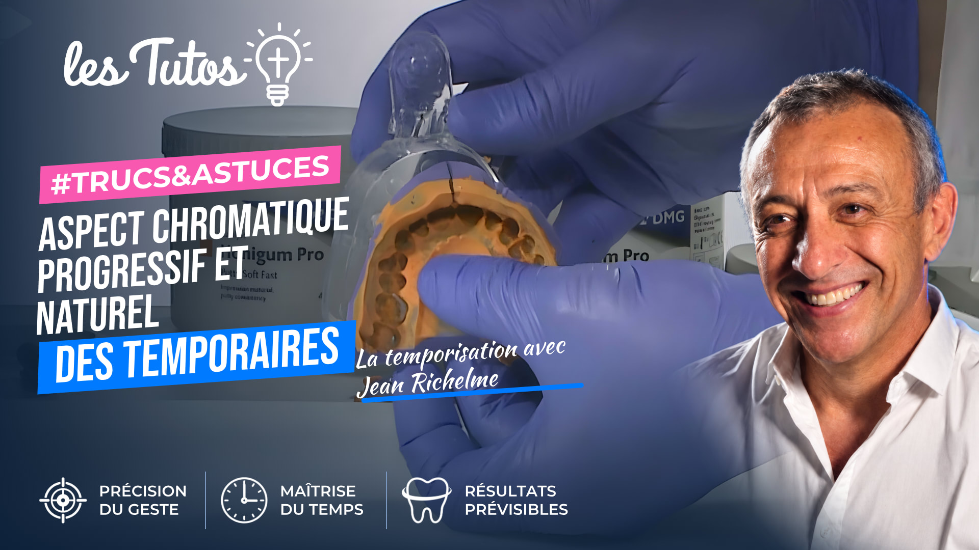 Aspect chromatique progressif et naturel des temporaires (Tuto, saison 1 épisode 10) : Reproduction de la chromaticité naturelle des dents dans le…