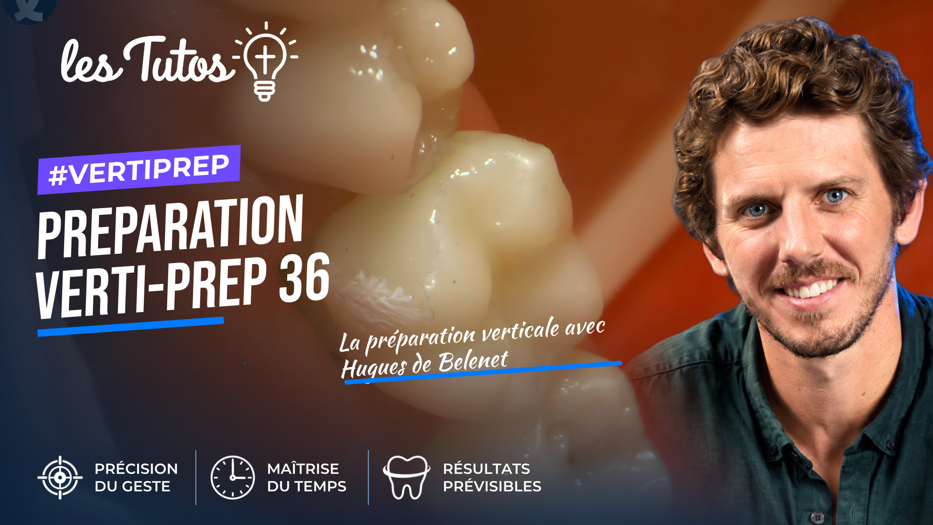 Preparation verti-prep 36 (Tuto, saison 2 épisode 21) : Démonstration muette : une préparation Verti-Prep sur la molaire 36, du build-up adhésif à…