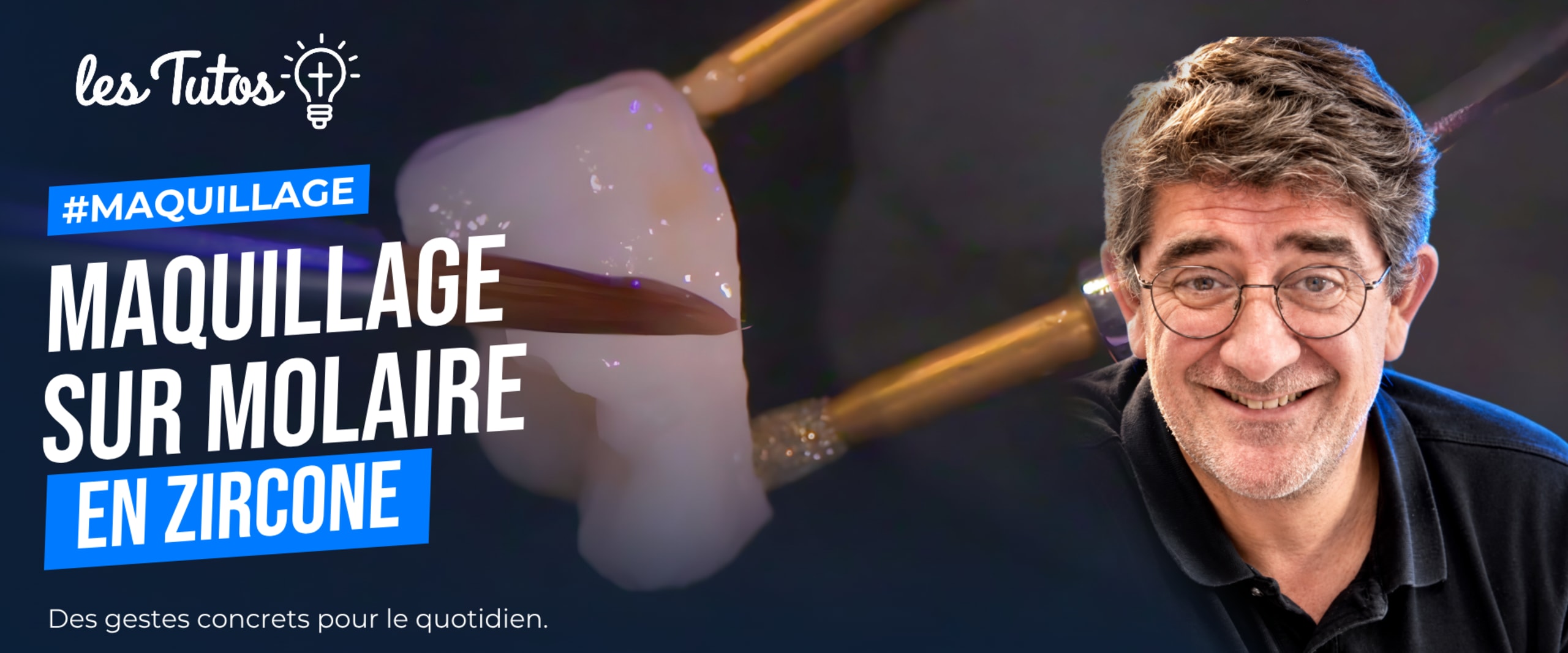 Maquillage sur molaire en zircone (Tuto, saison 2 épisode 28) : Démonstration technique muette de Benoit Capelle : le maquillage d'une molaire en…