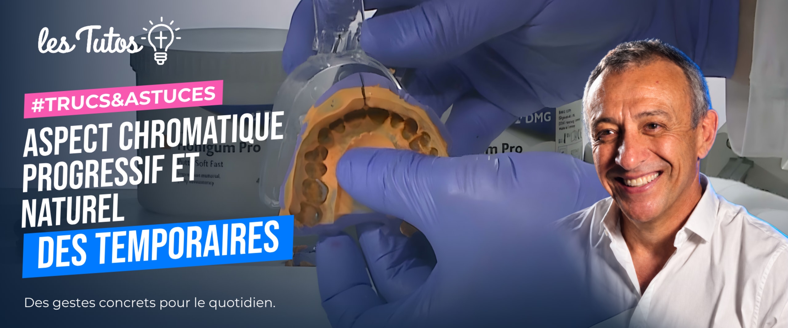 Aspect chromatique progressif et naturel des temporaires (Tuto, saison 1 épisode 10) : Reproduction de la chromaticité naturelle des dents dans le…