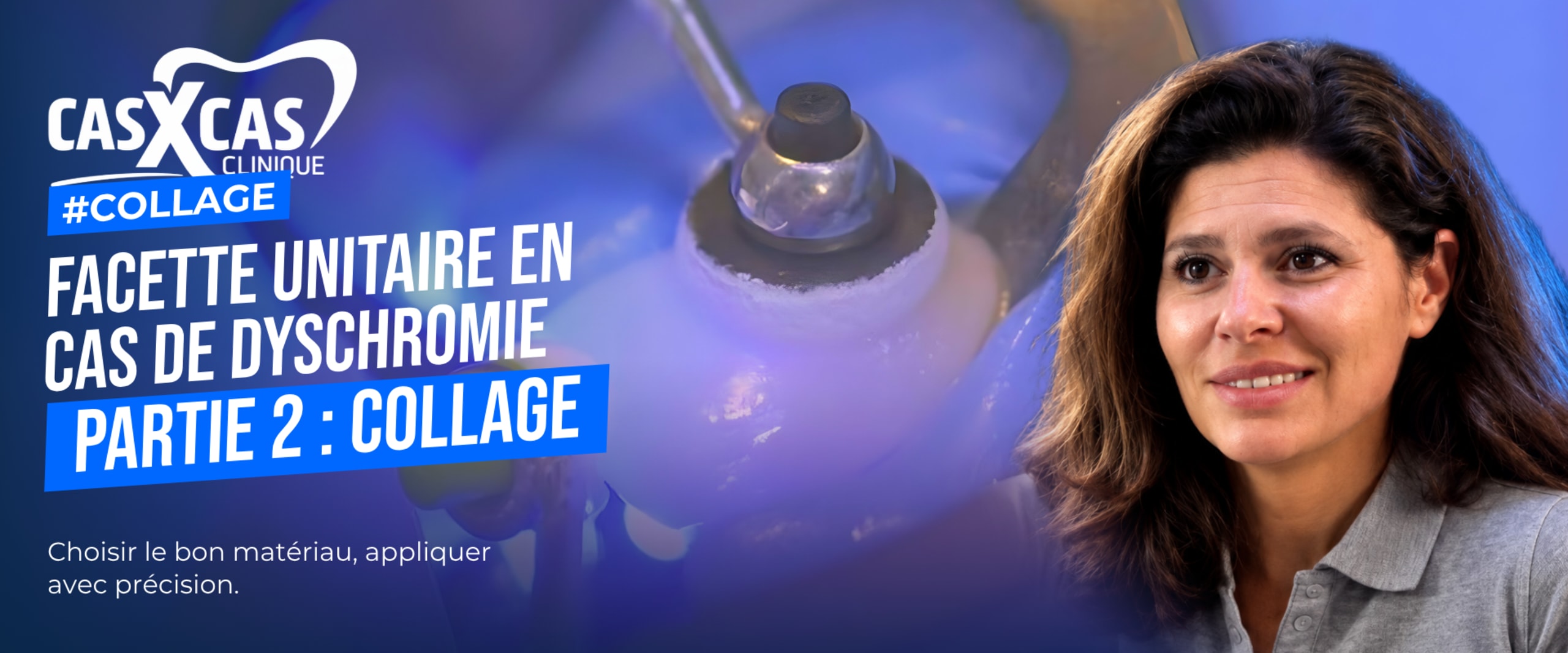 Facette unitaire en cas de dyschromie partie 2 : collage (Cas par Cas, saison 1 épisode 2) : Le Dr Stéphanie Ortet présente les techniques de…