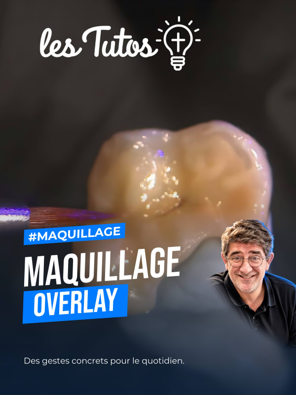 Maquillage overlay (Tuto, saison 2 épisode 26) : Démonstration muette de Benoit Capelle : la technique de maquillage d'un overlay prothétique…
