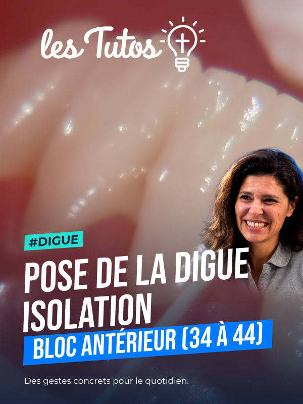 Pose de la digue isolation du bloc antérieur (34 à 44) (Tuto, saison 1 épisode 21) : Isolation du bloc antérieur à l'aide d'un champ opératoire