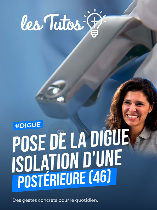 Pose de la digue isolation d'une dent postérieure (46) (Tuto, saison 1 épisode 23) : Isolation unitaire postérieure à l'aide de la méthode "parachute"