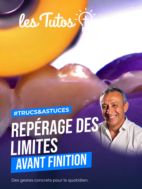 Repérage des limites avant finition (Tuto, saison 1 épisode 11) : Marquage du point de contact et des limites de préparation avant finition