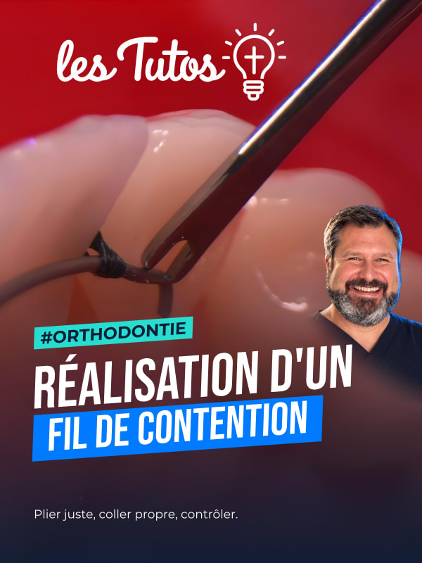 Réalisation d'un fil de contention (Tuto, saison 2 épisode 33) : Démonstration muette de Sébastien Nicolas et Guillaume Joseph : la confection…