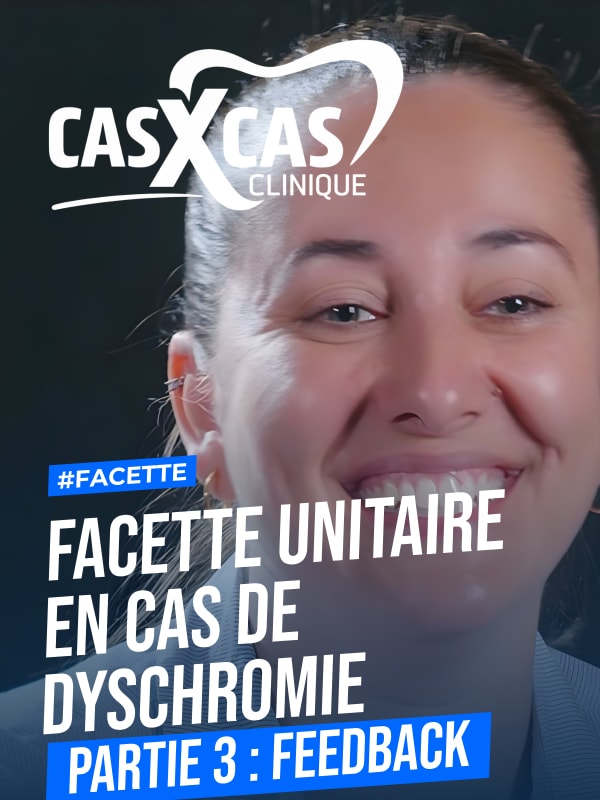 Facette unitaire en cas de dyschromie partie 3 : feedback (Cas par Cas, saison 1 épisode 3) : Dans la conclusion de cette série sur les facettes…