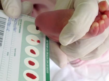 В Дагестане новорожденных теперь проверяют на 36 сложных генетических патологий