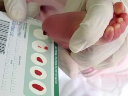 В Дагестане новорожденных проверяют на 36 сложных генетических патологий