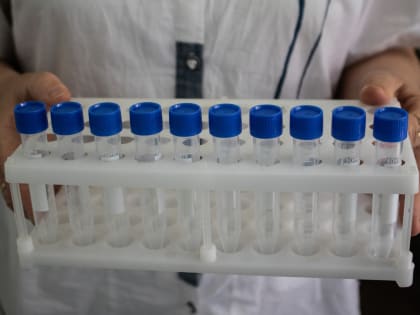 Города и районы Ставрополья с наибольшим числом заболевших COVID-19 на 01.02.2023