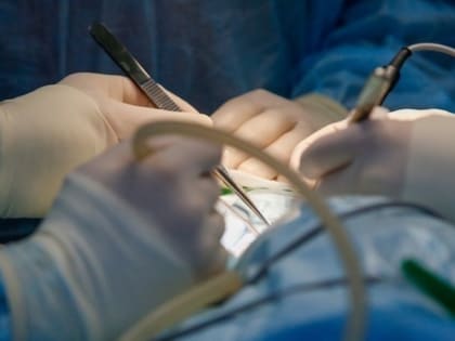Врачи сосудистого центра в Пятигорске проводят операции на «работающем» сердце