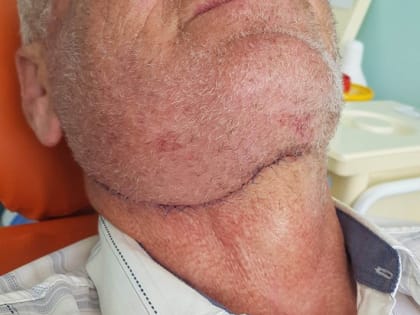 В больнице скорой помощи Ставрополя спасет ЗD-печать в челюстно-лицевой хирургии