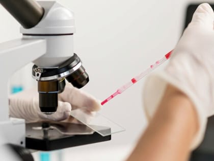 Бешенство: опасность, диагностика, предотвращение