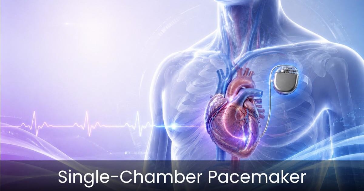 SIngle Chamber Pacemaker