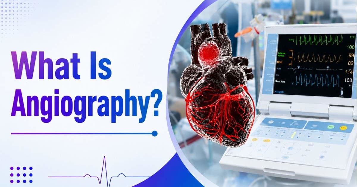 What Is Angiography