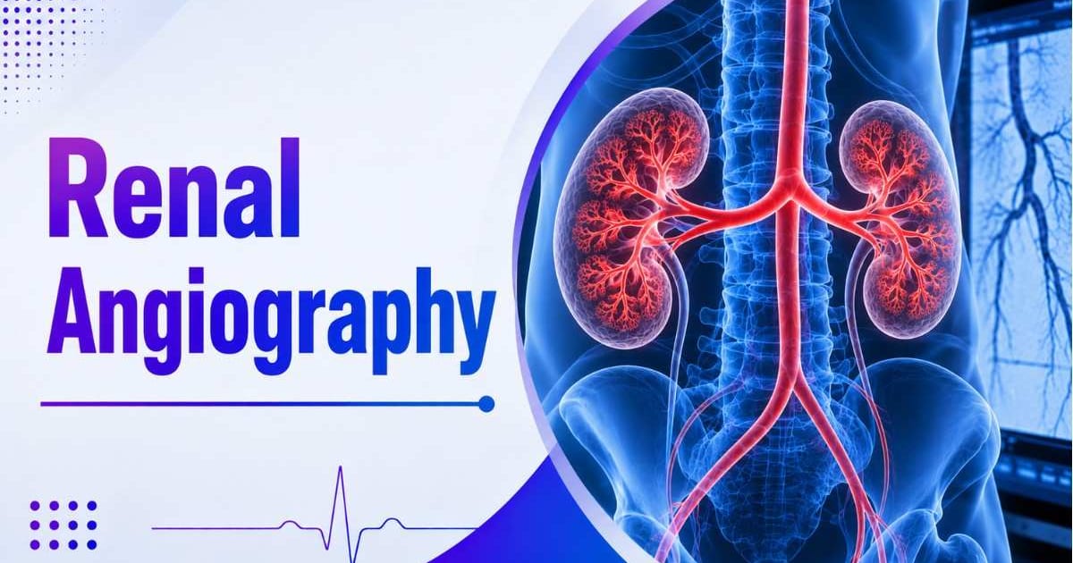Renal Angiography