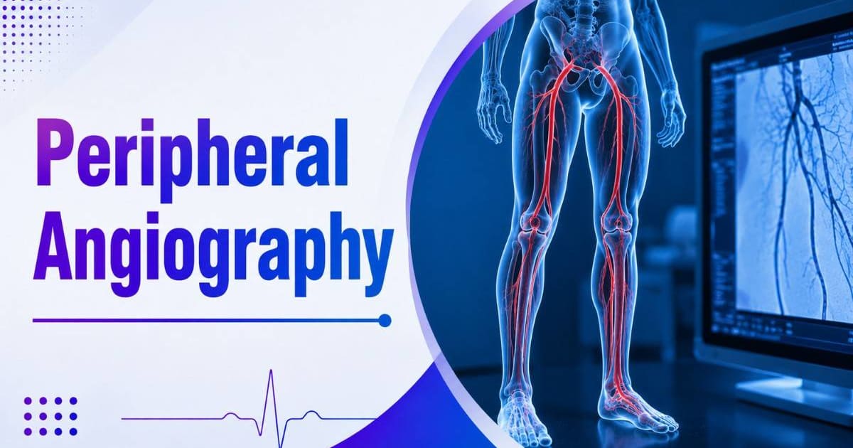 Peripheral Angiography
