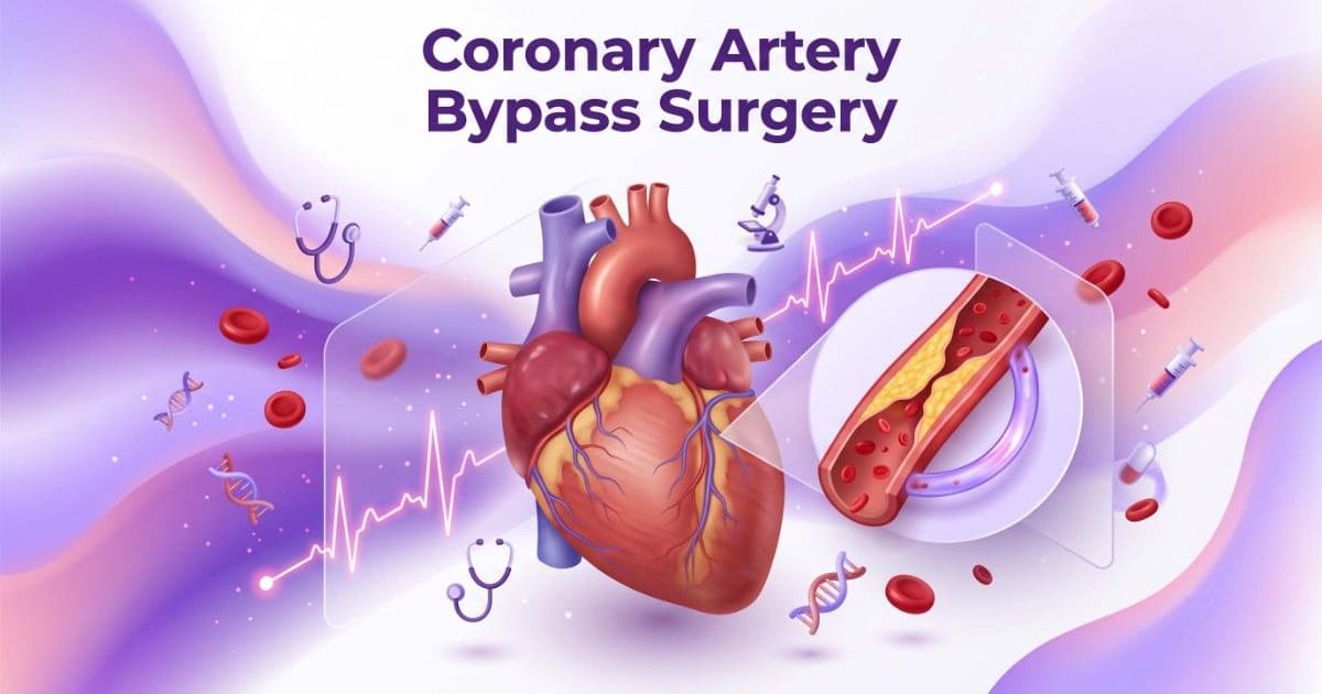 Coronary Artery Bypass Surgery