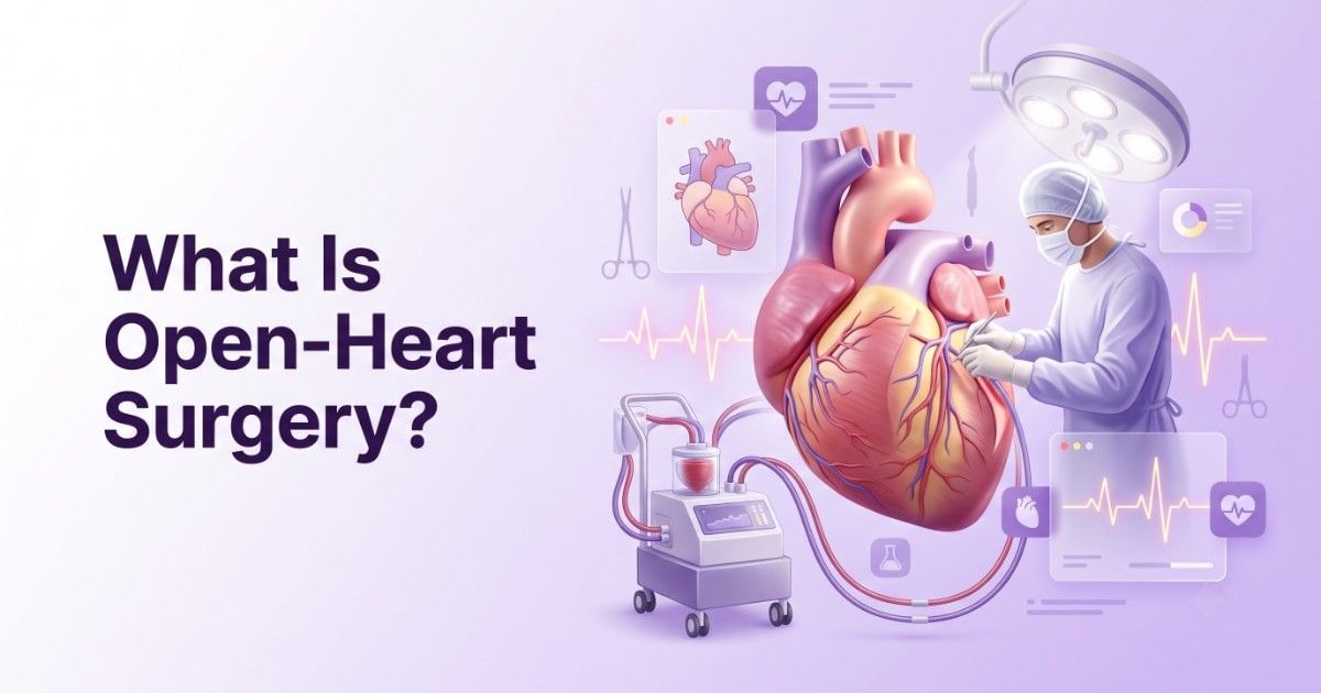 What Is Open‑Heart Surgery