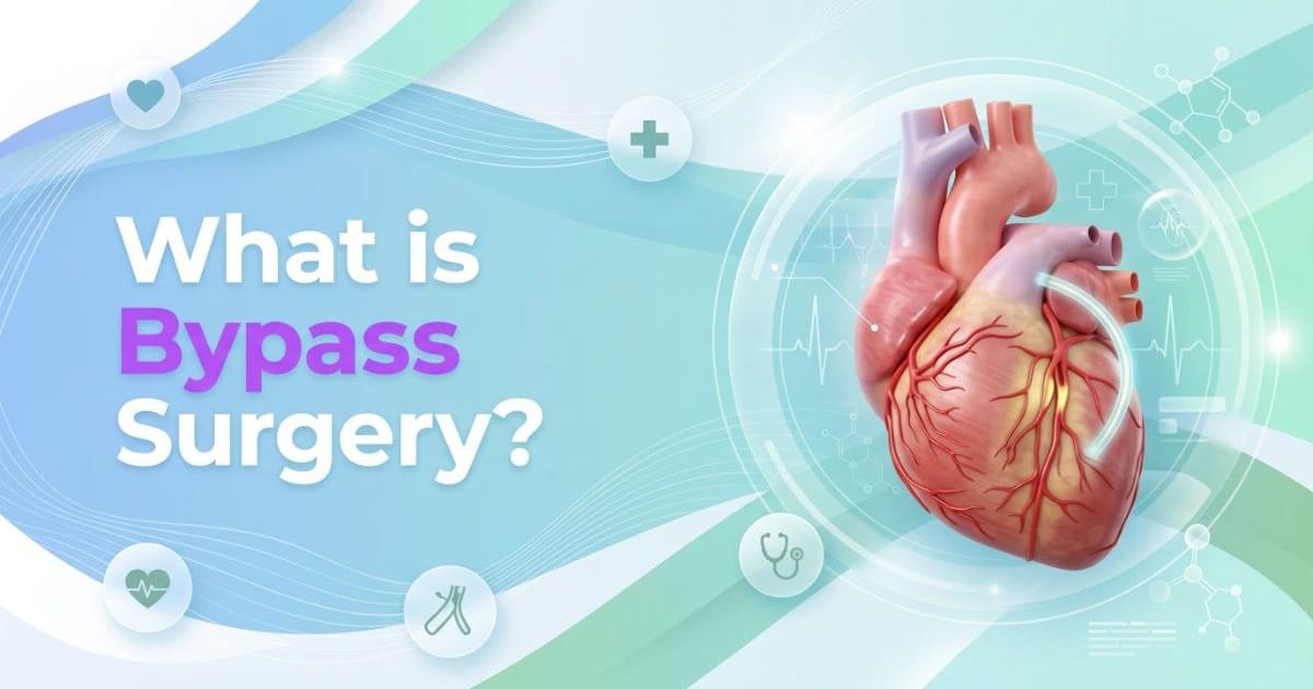 What is Bypass Surgery