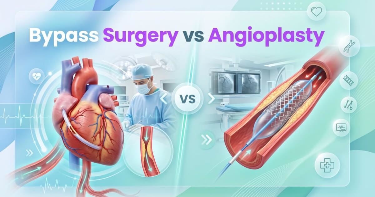 Bypass Surgery vs Angioplasty