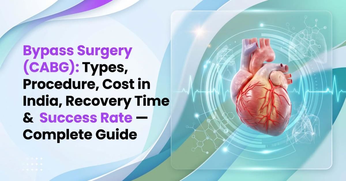 Bypass Surgery (CABG): Types, Procedure, Cost in India, Recovery Time & Success Rate — Complete Guide