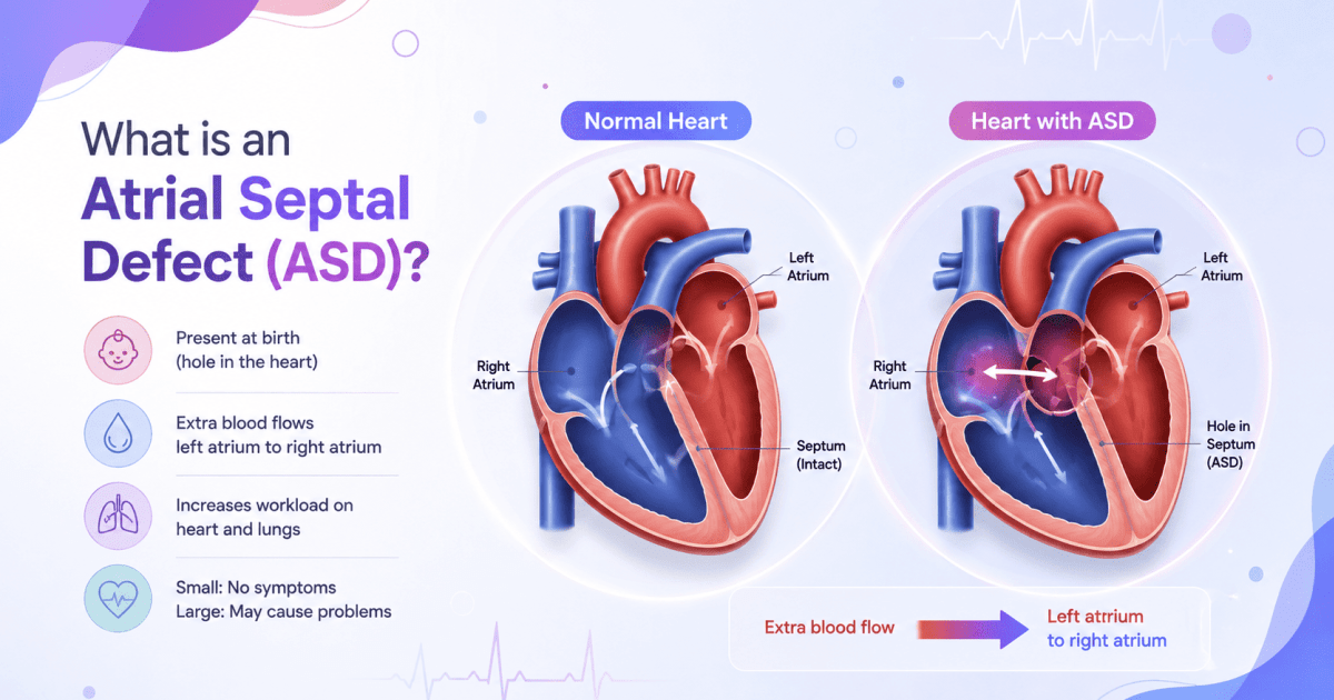 What is an atrial septal defect