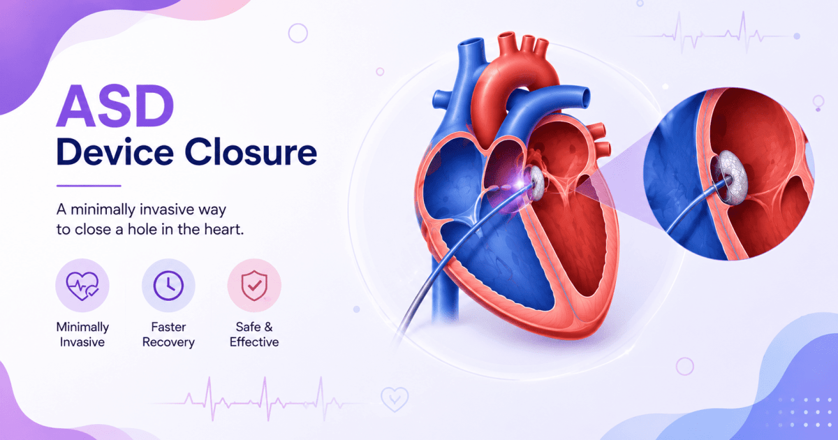 ASD device closure
