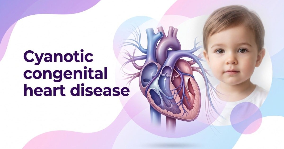 Cyanotic congenital heart disease
