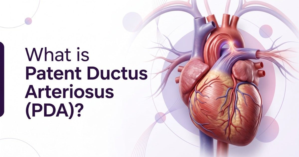 Patent Ductus Arteriosus